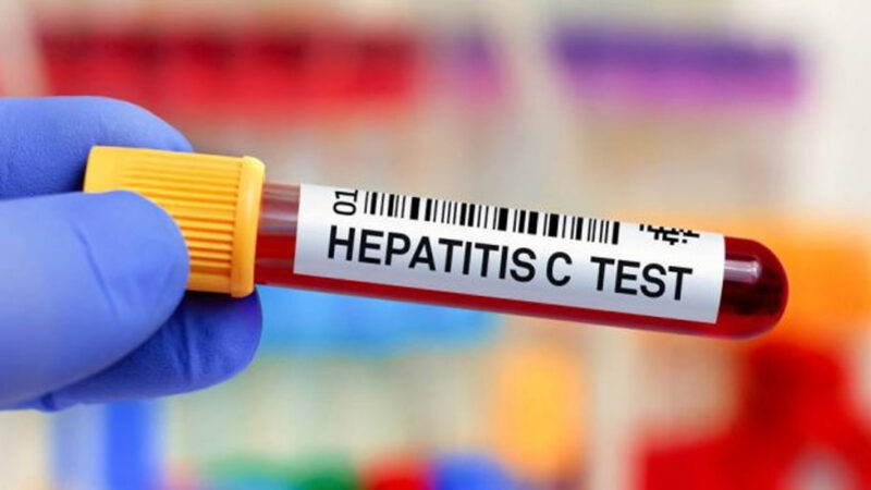 Casos de VIH y hepatitis registraron disminución del 20 % en Monagas