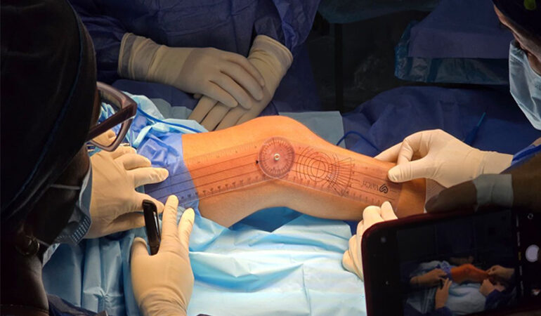 Niño de 11 años protagoniza primera cirugía reconstructiva ortopédica en Monagas