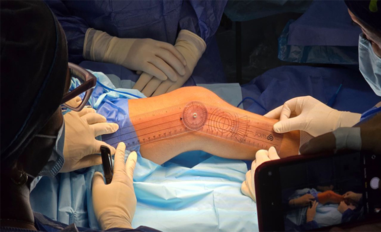 Niño de 11 años protagoniza primera cirugía reconstructiva ortopédica en Monagas